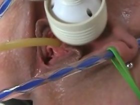自分自身のためのカテーテル挿入
