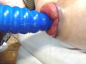 挿入
